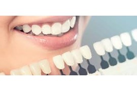 استخدام بازاریاب لابراتوار دندانسازی دیجیتال